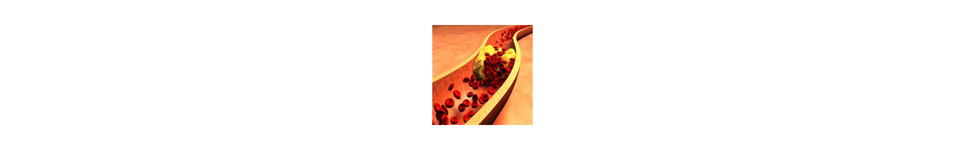 Cholesterol