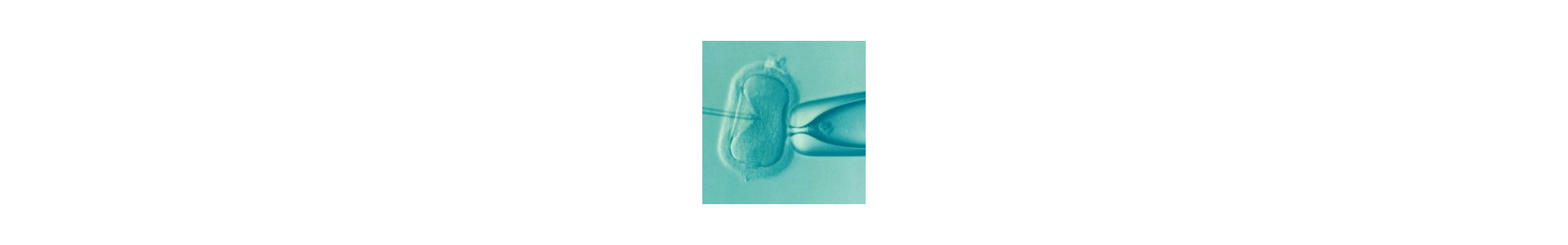 Infertility