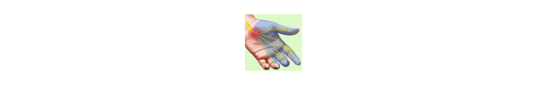Nervous diseases